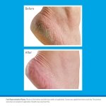 O’Keeffe’s Healthy Feet Tube, 80ml - Foot Cream for Very Dry Skin, Cracked Heels and Feet | Instantly Boosts Moisture Levels, Creates a Protective Layer & Prevents Moisture Loss - Image 4